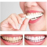 Carillas dentales