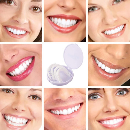 Carillas dentales 💖 Sonríe sin miedo con esta solución mágica 💖