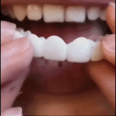 2. 🦷 ¡mejora tu sonrisa y transforman tu vida hoy mismo! 🦷